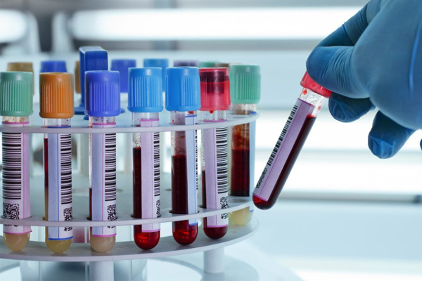 Rainbow Labs Complete Guide Home Blood Testing Health